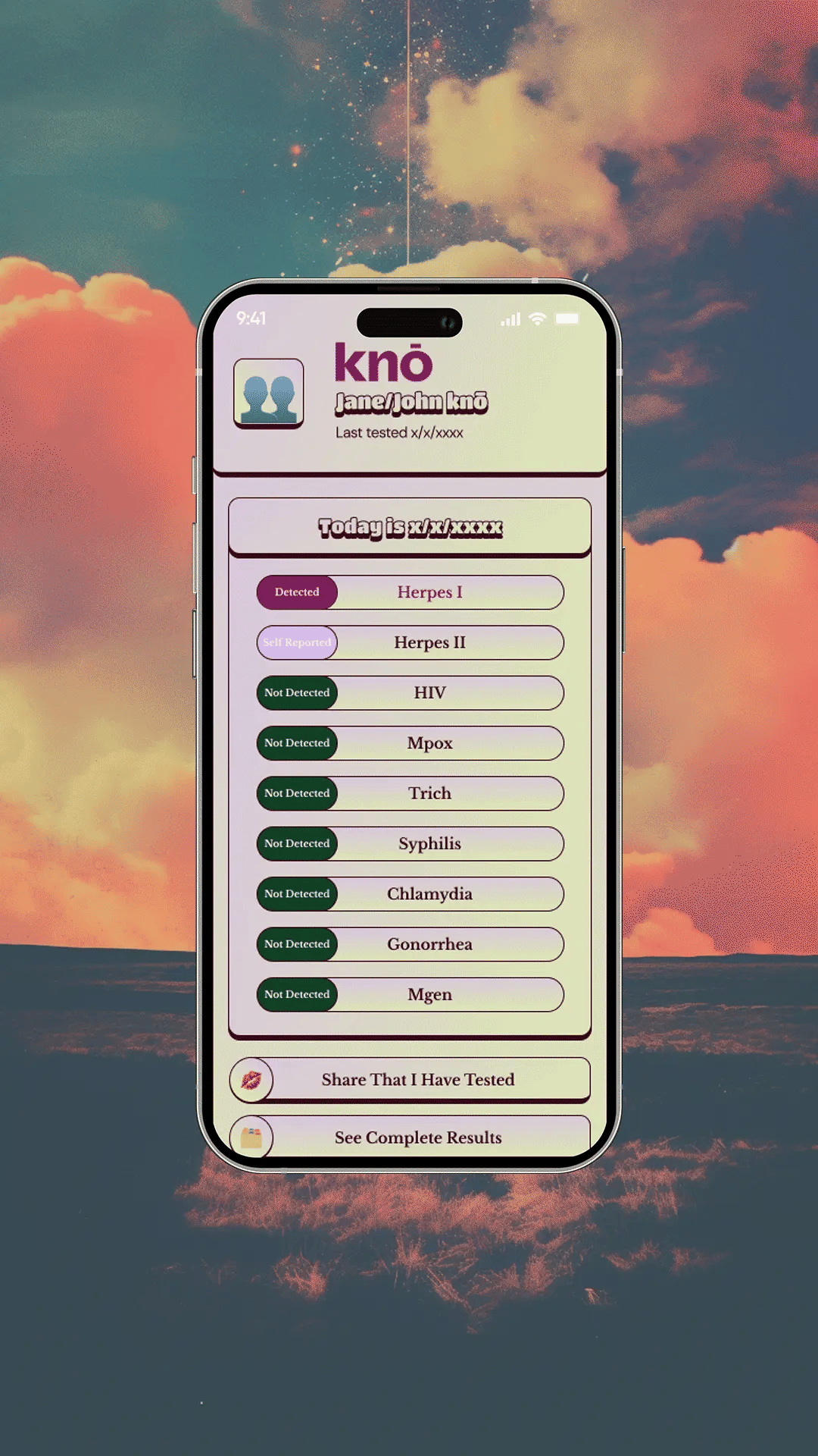 Thingtesting x knō